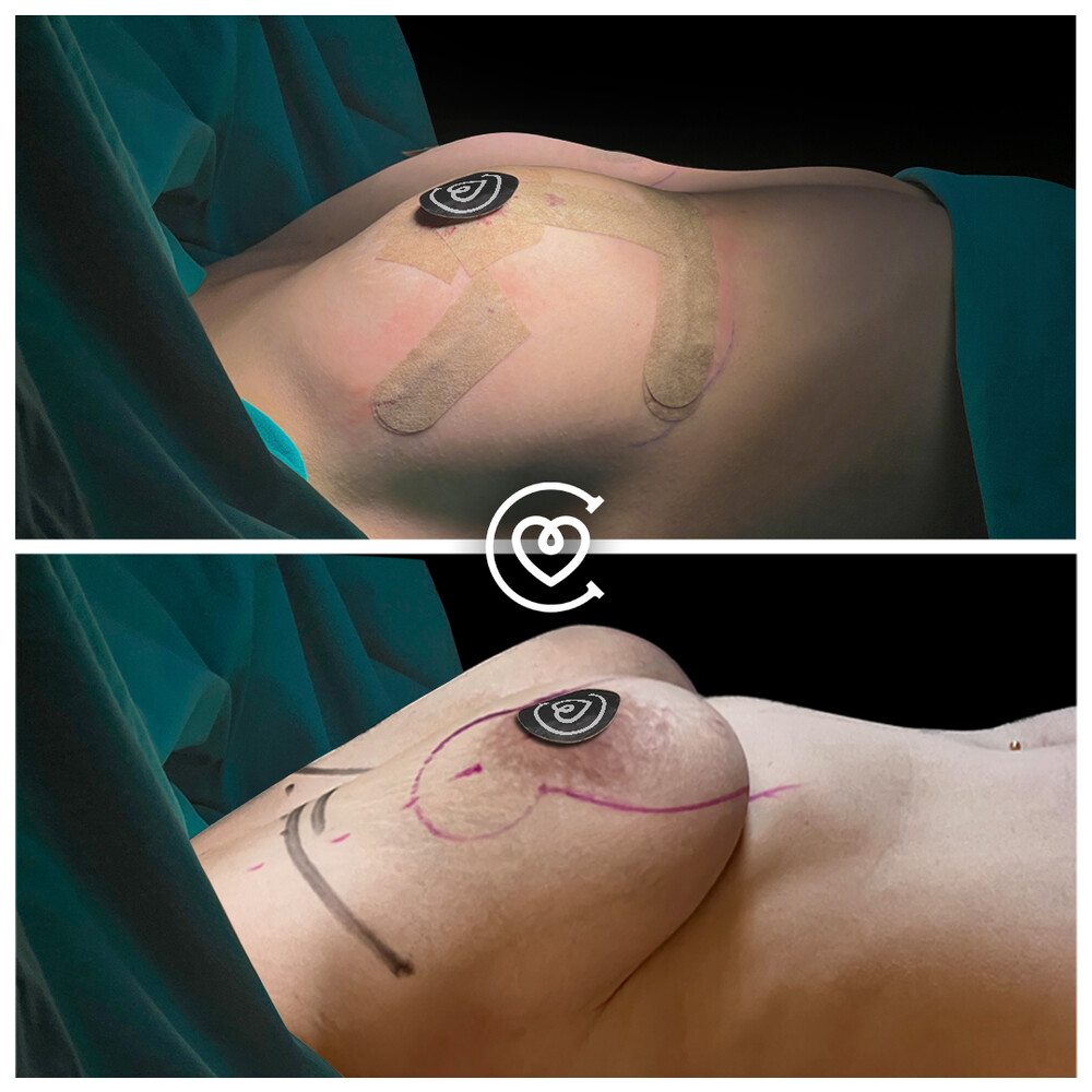 Clinic Results Gallery